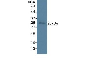 WB of Protein Standard: different control antibody against Highly purified E.