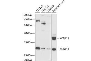 Western blot analysis of extracts of various cell lines, using KCNJ11 antibody (ABIN6129430, ABIN6142721, ABIN6142722 and ABIN6221442) at 1:1000 dilution. (KCNJ11 Antikörper  (AA 171-390))