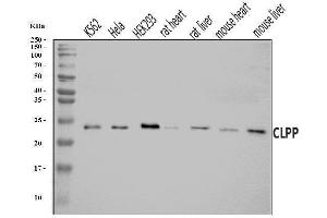 Western blot analysis of CLPP using anti-CLPP antibody (ABIN7602061).