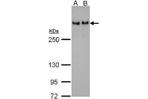 WB Image 53BP1 antibody [N1], N-term detects TP53BP1 protein by Western blot analysis.