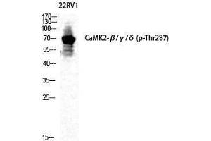 Western Blotting (WB) image for anti-CaMKIIbeta/gamma/delta (pThr287) antibody (ABIN3182661) (CaMKIIbeta/gamma/delta Antikörper  (pThr287))