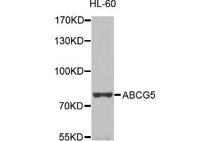 Western blot analysis of extracts of HL-60  cells, using ABCG5 antibody.