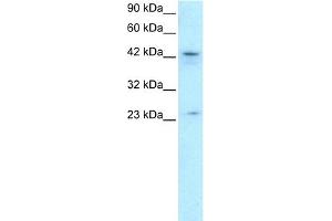 WB Suggested Anti-ZNF365 Antibody Titration: 0. (ZNF365 Antikörper  (N-Term))