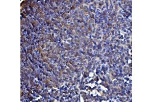 IHC analysis of DLST using anti-DLST antibody (ABIN7599412). (DLST Antikörper  (AA 1-453))