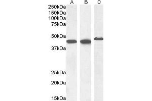 (ABIN185271) (1 μg/mL) staining of Human Heart (A), (0. (Smooth Muscle Actin Antikörper  (N-Term))