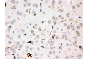 IHC analysis of Ceruloplasmin/CP using anti-Ceruloplasmin/CP antibody (ABIN3044508). (Ceruloplasmin Antikörper  (AA 20-258))