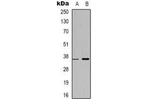 Western blot analysis of ZNF265 expression in HepG2 (A), MCF7 (B) whole cell lysates.