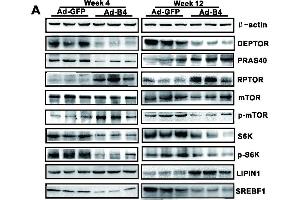Western Blotting (WB) image for anti-Mechanistic Target of Rapamycin (serine/threonine Kinase) (mTOR) (C-Term) antibody (ABIN2855088)
