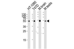 Western blot analysis of lysate from HT-1080, T47D cell line, mouse brain and testis tissue lysate using TUBA6 antibody at 1:1000. (TUBA1C Antikörper  (N-Term))