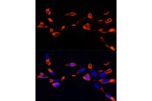 Immunofluorescence analysis of NIH/3T3 cells using MCTS1 antibody (ABIN6132341, ABIN6143657, ABIN6143658 and ABIN6224877) at dilution of 1:100 (40x lens). (MCTS1 Antikörper  (AA 1-181))