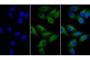 Detection of TUBb in Human MCF7 cell using Anti-Tubulin Beta (TUBb) Monoclonal Antibody (TUBB Antikörper  (AA 170-419))