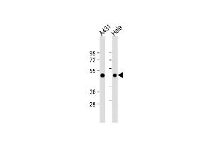 All lanes : Anti-RAD9 Antibody (BH3 Domain Specific) at 1:4000 dilution Lane 1: A431 whole cell lysate Lane 2: Hela whole cell lysate Lysates/proteins at 20 μg per lane. (RAD9A Antikörper  (AA 1-30))