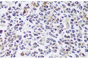 Immunohistochemistry of paraffin-embedded Human tonsil using ECH1 Polyclonal Antibody at dilution of 1:150 (40x lens). (ECH1 Antikörper)