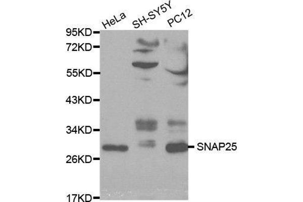 SNAP25 Antikörper  (AA 1-206)