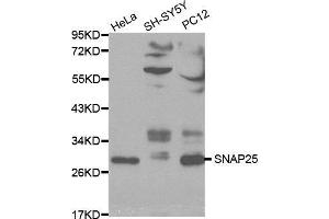 Western blot analysis of extracts of various cell lines, using SNAP25 antibody. (SNAP25 Antikörper  (AA 1-206))