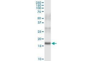 Immunoprecipitation of PLA2G16 transfected lysate using rabbit polyclonal anti-PLA2G16 and Protein A Magnetic Bead (PLA2G16 (Human) IP-WB Antibody Pair)