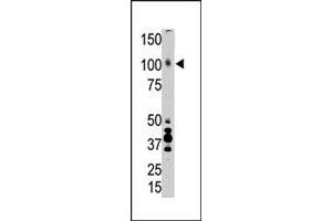 The LRP8 polyclonal antibody  is used in Western blot to detect LRP8 in placenta tissue lysate. (LRP8 Antikörper  (AA 934-963))