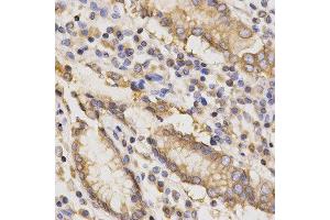 Immunohistochemistry (IHC) image for anti-TAP Binding Protein (Tapasin) (TAPBP) antibody (ABIN1875423) (TAPBP Antikörper)