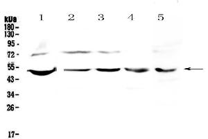 Western blot analysis of ESRRG using anti-ESRRG antibody . (ESRRG Antikörper  (AA 302-458))