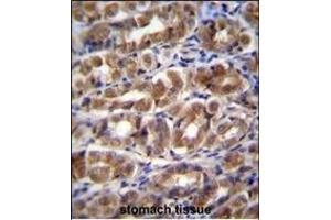 FABP2 Antibody (N-term) (ABIN656830 and ABIN2846039) immunohistochemistry analysis in formalin fixed and paraffin embedded human stomach tissue followed by peroxidase conjugation of the secondary antibody and DAB staining.