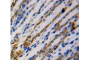Used in DAB staining on fromalin fixed paraffin- embedded kidney tissue (SPRY2 Antikörper  (AA 116-305))