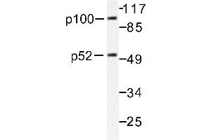 Image no. 2 for anti-Nuclear Factor of kappa Light Polypeptide Gene Enhancer in B-Cells 2 (NFKB2) antibody (ABIN271740) (NFKB2 Antikörper)