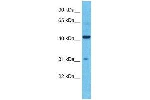 Host:  Rabbit  Target Name:  KCNK4  Sample Type:  Colorectal Tumor lysates  Antibody Dilution:  1. (KCNK4 Antikörper  (N-Term))