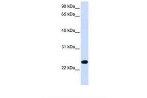 Image no. 1 for anti-Paired Immunoglobin-Like Type 2 Receptor beta (PILRB) (AA 146-195) antibody (ABIN6738290) (PILRB Antikörper  (AA 146-195))