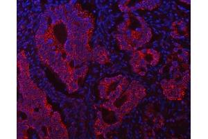 IF analysis of ECHS1 using anti-ECHS1 antibody (ABIN7599813).