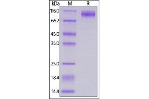 Biotinylated HIV-1 [HIV-1/Clade B/C (CN54)] GP120, His,Avitag on  under reducing (R) condition.