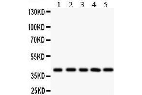 HLA-C Antikörper  (C-Term)