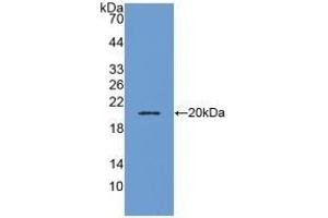 Detection of Recombinant ADM, Human using Polyclonal Antibody to Adrenomedullin (ADM) (Adrenomedullin Antikörper  (AA 22-147))