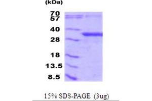 NFU1 Iron-Sulfur Cluster Scaffold (NFU1) (AA 10-254) protein (His tag)
