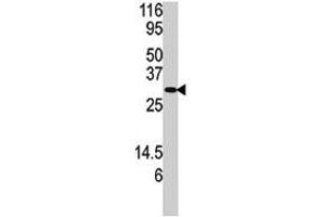 Western blot analysis of DUSP3 polyclonal antibody  in SK-BR-3 cell lysate. (Dual Specificity Phosphatase 3 (DUSP3) (N-Term) Antikörper)