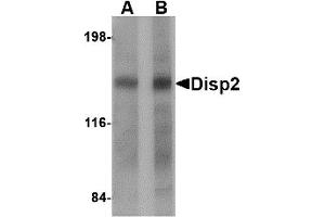 Western Blotting (WB) image for anti-Dispatched Homolog 2 (DISP2) (C-Term) antibody (ABIN1030361) (DISP2 Antikörper  (C-Term))