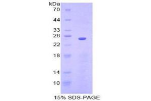 SDS-PAGE (SDS) image for Sprouty Homolog 3 (SPRY3) (AA 91-288) protein (His tag) (ABIN1878980)
