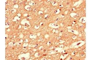 Immunohistochemistry of paraffin-embedded human brain tissue using ABIN7148421 at dilution of 1:100 (Complexin 1 Antikörper  (AA 1-134))
