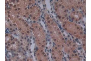 Immunohistochemistry (IHC) image for anti-Glucokinase (Hexokinase 4) Regulator (GCKR) (AA 17-261) antibody (ABIN7442828)