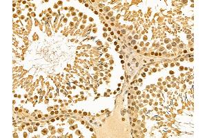 ABIN6262398 and ABIN6269012 at 1/100 staining Rat testis tissue by IHC-P. (HSP70 Antikörper  (C-Term))