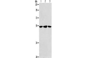 Gel: 8 % SDS-PAGE, Lysate: 40 μg, Lane 1-3: Human fetal liver tissue, hela cells, Human fetal brain tissue, Primary antibody: ABIN7189774(ALDH9A1 Antibody) at dilution 1/240, Secondary antibody: Goat anti rabbit IgG at 1/8000 dilution, Exposure time: 30 seconds (ALDH9A1 Antikörper)