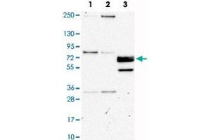 Western Blot analysis of Lane 1: RT-4, Lane 2: U-251MG sp and Lane 3: human plasma (IgG/HSA depleted) with CUX1 polyclonal antibody . (CUX1 Antikörper)