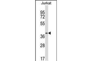 Western blot analysis in Jurkat cell line lysates (35ug/lane). (PAQR6 Antikörper  (C-Term))