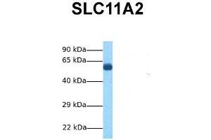 Host:  Rabbit  Target Name:  SLC11A2  Sample Tissue:  Human Fetal Lung  Antibody Dilution:  1. (SLC11A2 Antikörper  (N-Term))