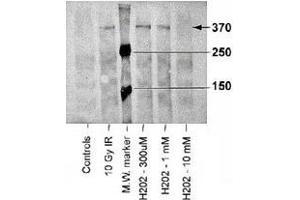 Western blot analysis of ATM on irradiated or peroxidated human fibroblasts using ATM monoclonal antibody, clone 10H11.