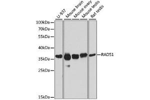 Western blot analysis of extracts of various cell lines, using RAD51 antibody. (RAD51 Antikörper  (AA 50-150))