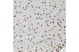 Immunohistochemistry of paraffin-embedded mouse liver using KDM4A antibody (ABIN5975678) at dilution of 1/100 (40x lens). (KDM4A Antikörper)