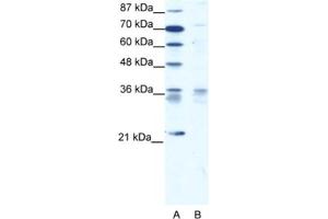 Western Blotting (WB) image for anti-BARX Homeobox 1 (BARX1) antibody (ABIN2460616) (BARX1 Antikörper)