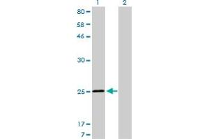 Western Blot analysis of TNNI3 expression in transfected 293T cell line by TNNI3 monoclonal antibody (M04), clone 1E7. (TNNI3 Antikörper  (AA 102-210))