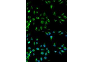 Immunofluorescence analysis of HeLa cell using RASSF1 antibody. (RASSF1 Antikörper  (AA 101-340))