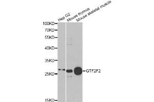 Western blot analysis of extracts of various cell lines, using GTF2F2 antibody. (GTF2F2 Antikörper)